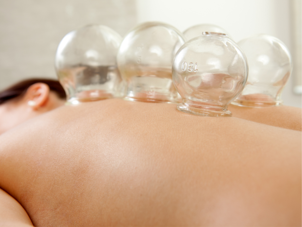 Cups placed on skin  in cupping therapy